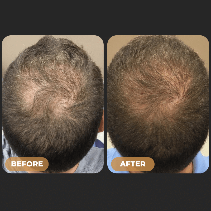 SPARTAN™ - Root Activator Conditioner