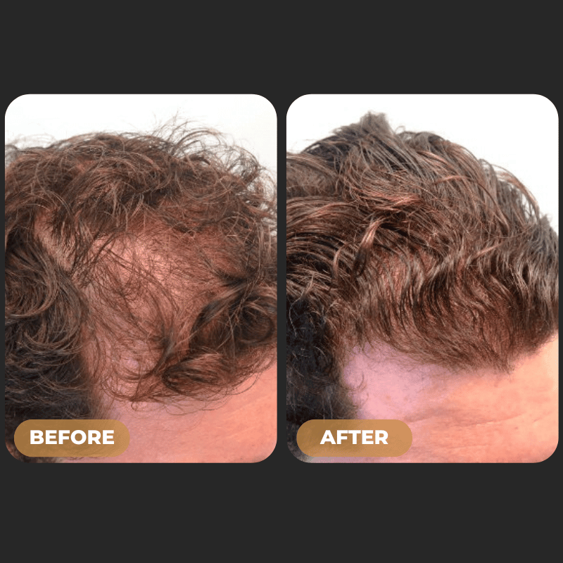 SPARTAN™ - Root Activator Conditioner