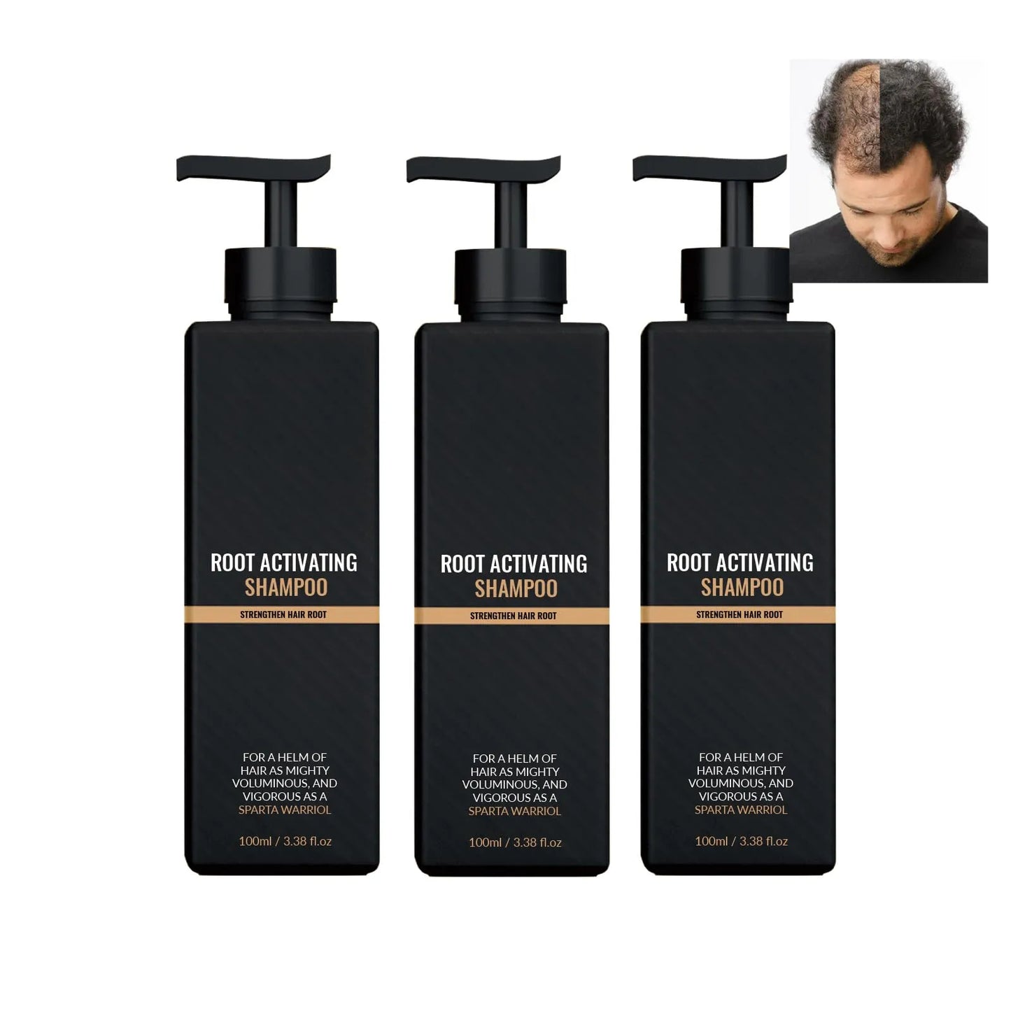 SPARTAN™ - Root Activator Shampoo